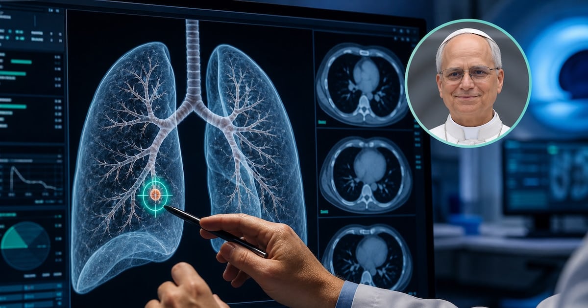 Nódulo pulmonar: por qué un hallazgo de tres milímetros puede terminar en quirófano