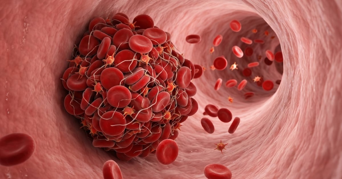 Trombosis venosa: por qué un dolor en la pierna puede ser una urgencia y en qué momentos de la vida el riesgo se dispara